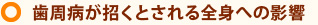 歯周病が招くとされる全身への影響